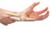 Điều trị bệnh đau cổ tay an toàn hiệu quả 